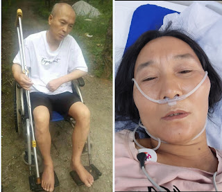 获刑4年6个月的淋巴癌晚期患者、维权人士尹登珍女士被连续剥夺正常医疗救治100天